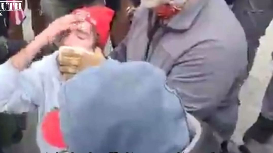 ⁣Capitol Police shoot INNOCENT Jan 6 Protestor in the FACE with 40mm Concussion Grenade!
